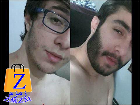 zyt-bold-beard-alasl-big-1